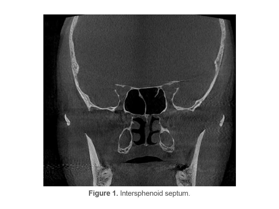 Figure 1. Intersphenoid septum.