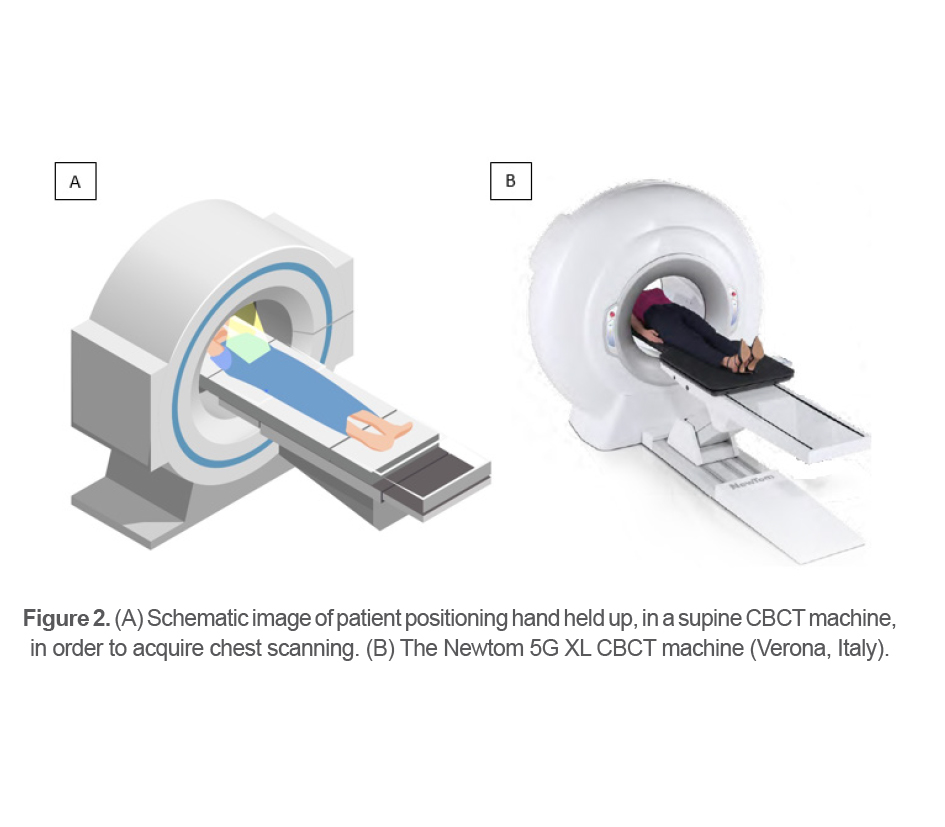 Figure 2. (A) Schematic image of patient positioning hand held up, in a supine CBCT machine, in order to acquire chest scanning. (B) The Newtom 5G XL CBCT machine (Verona, Italy).